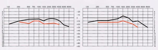 Ideal Listening Curve