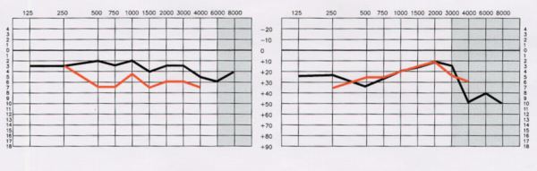 Ideal Listening Curve