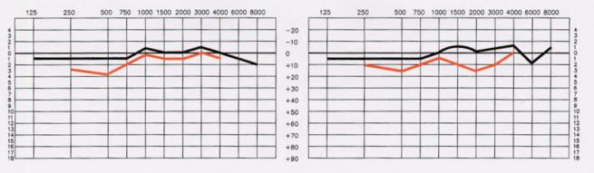 Ideal Listening Curve