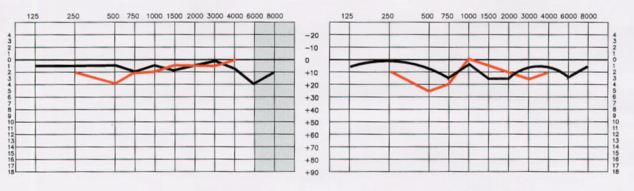 Ideal Listening Curve