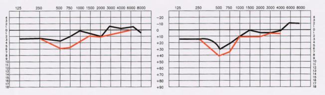 Ideal Listening Curve