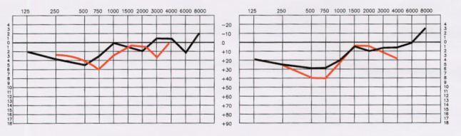 Ideal Listening Curve