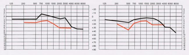 Ideal Listening Curve