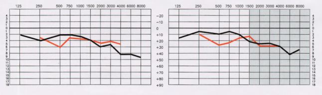 Ideal Listening Curve